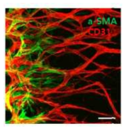 혈관 세포간의 상호작용을 평가하기 위한 미세유체 공배양 시스템 확립