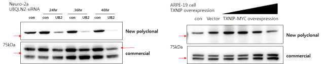 UBQLN2-specific polyclonal antibody 제작