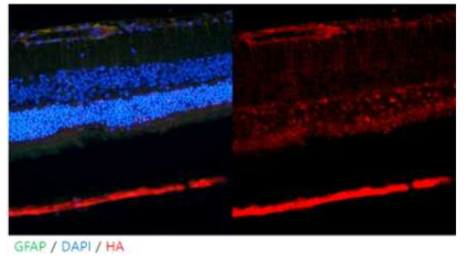 유리체강 내 AAV9 주사를 이용한 Nia 발현 시스템 확립