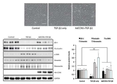 CCN5 발현에 의한 TGF-β2 유발 EMT 억제 효과(1)