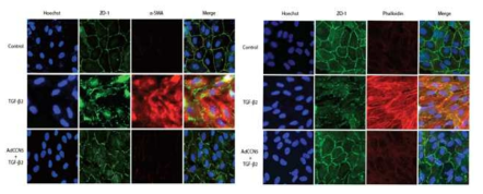 CCN5 발현에 의한 TGF-β2 유발 EMT 억제 효과 (3)