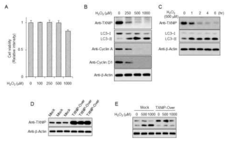 산화스트레스에 의한 TXNIP 발현 저하와 자가포식작용 증가