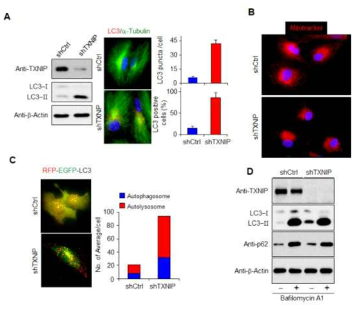 TXNIP 유전자 억제에 의한 자가포식작용 증가