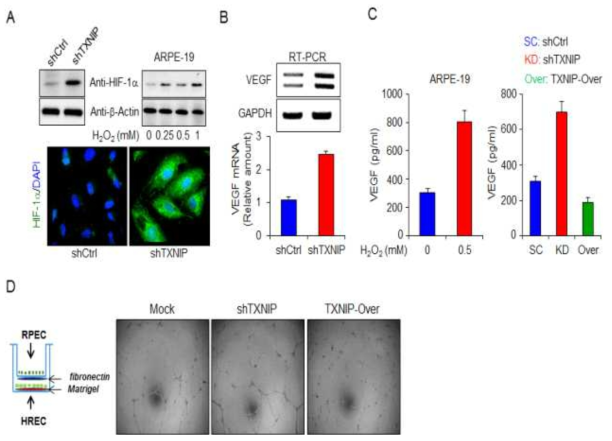 TXNIP 유전자 억제에 의한 혈관내피성장인자 발현 증가