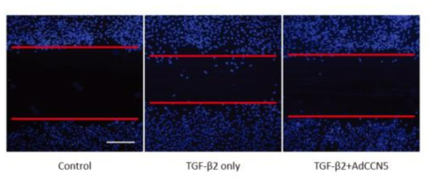 TGF-β에 의한 ARPE-19 세포의 이동능력 증가와 CCN5에 의한 변화