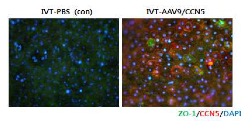 CCN5 유전자 발현에 의한 Ccl2 knockout 생쥐의 망막색소상피 치밀이음부 손상 억제