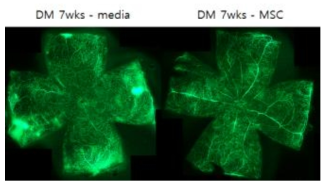 당뇨망막병증 생쥐에서 안구내 중간엽 줄기세포 주사 후 혈관투과성 평가