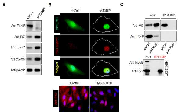 TXNIP 조절을 통한 망막색소상피 내 p53 발현 조절