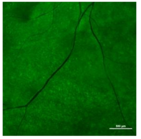 Cynomolgus 원숭이의 망막하 공간에 융합 세포치료제 후보물질 주사 후 30일째 획득한 망막에서 녹색형광단백질 발현을 확인함