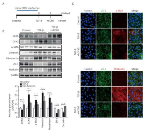 CCN5 발현 증가를 통한 transforming growth factor-β에 의한 망막색소상피세포의 섬유증적 변형 복원