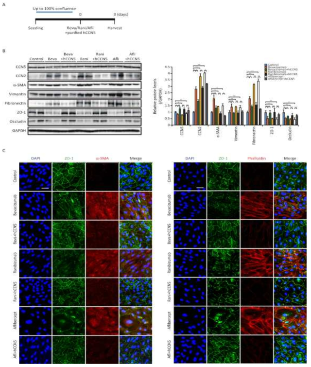 CCN5 단백질을 통한 anti-vascular endothelial growth factor agent에 의한 망막색소상피세포의 섬유증적 변형 예방