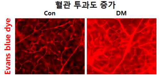 에반스 블루색소를 이용한 혈관투과성 평가