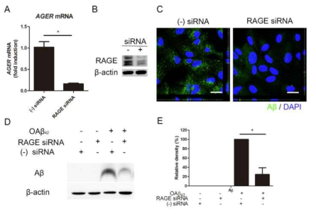 최종당화산물 수용체에 의한 아밀로이드베타의 세포내 축적