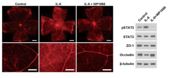 당뇨망막병증 황반부종의 유효인자인 IL-6와 STAT3 조절을 통한 혈관투과성 감소