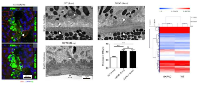 아밀로이드 베타를 과발현하는 5XFAD 생쥐에서 관찰되는 건성 노인성 황반변성의 특징적인 망막색소상피세포 변화