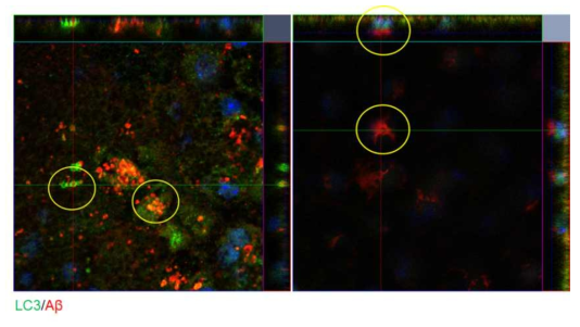 아밀로이드 베타의 유리체강 내 주사로 유발한 건성 노인성 황반변성 동물 모델에서 자가포식현상 확인