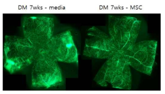 당뇨망막병증 생쥐에서 안구내 중간엽 줄기세포 주사 후 혈관투과성평가