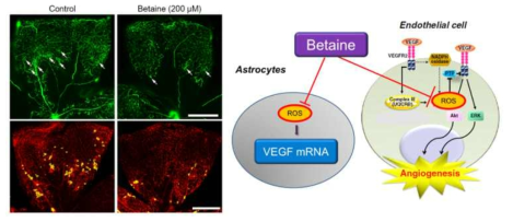 활성산소 조절을 통한 혈관내피세포성장인자의 조절