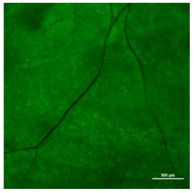 Cynomolgus 원숭이의 망막하 공간에 융합 세포치료제 후보물질 주사 후 30일째 획득한 망막에서 녹색형광단백질 발현을 확인함