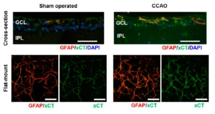 허혈 망막에서 별아교세포 내 cystine/glutamate antiporter 발현