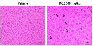 Ketoconazole 300 mg/kg 경구투여 후 간의 조직병리학적 변화