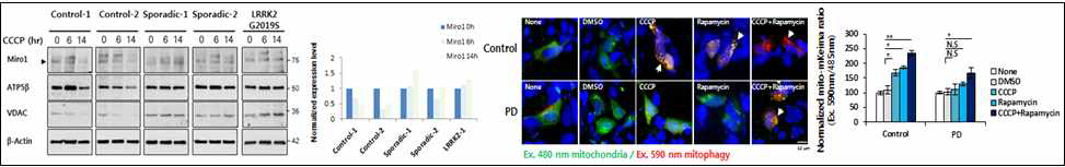 파킨슨병 특이적 Mitophagy 저해현상 확인 및 질환모세 세포 개발