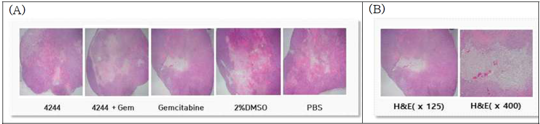 Evaluation of tumor necrosis after drug treatment in Panc-1 xenograft model. (A) each group (B) Gemcitabine