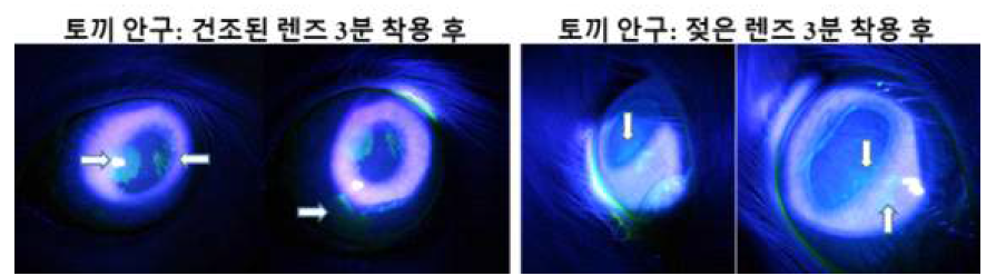 눈물 포집 렌즈 착용에 따른 안구 미란 발생 여부 확인 실험 결과