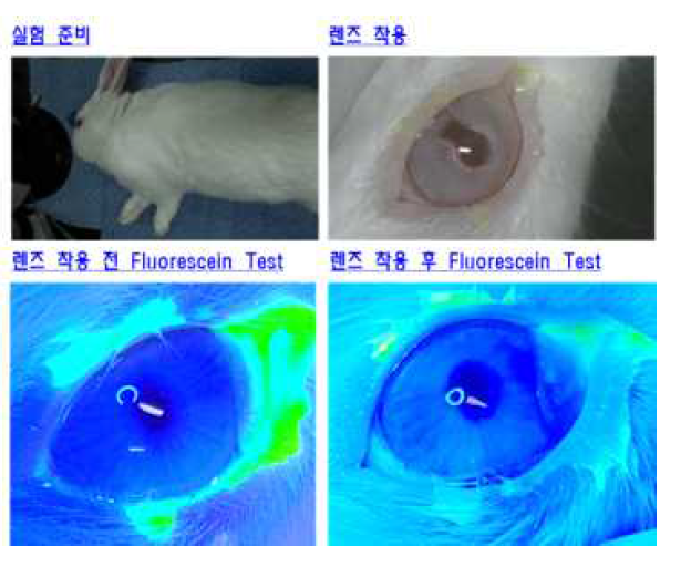 개선된 렌즈를 통한 각막 미란 발생 여부 확인