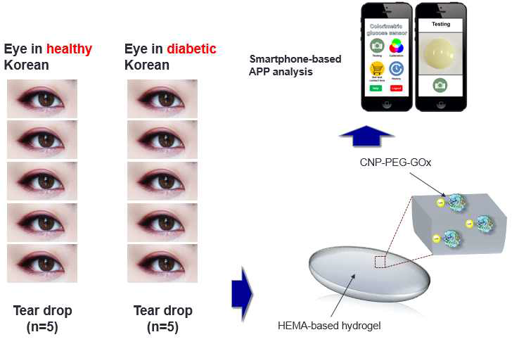 임상 눈물 검체를 이용한 눈물내 포도당 농도 측정 플랫폼 모식도