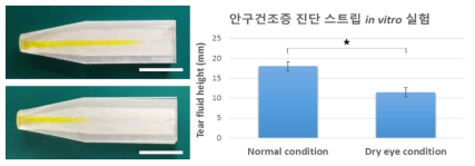 (좌) (상) 정상 환경과 (하) 안구건조증 모사 환경에서 3초간 포집한 optical 이미지, Scale bar: 5 mm, (우) 눈물 포집 결과