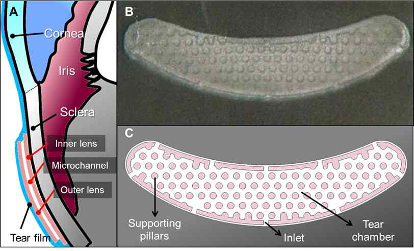 미세유관 시스템이 삽입된 눈물포집 렌즈의 2차원적 구조