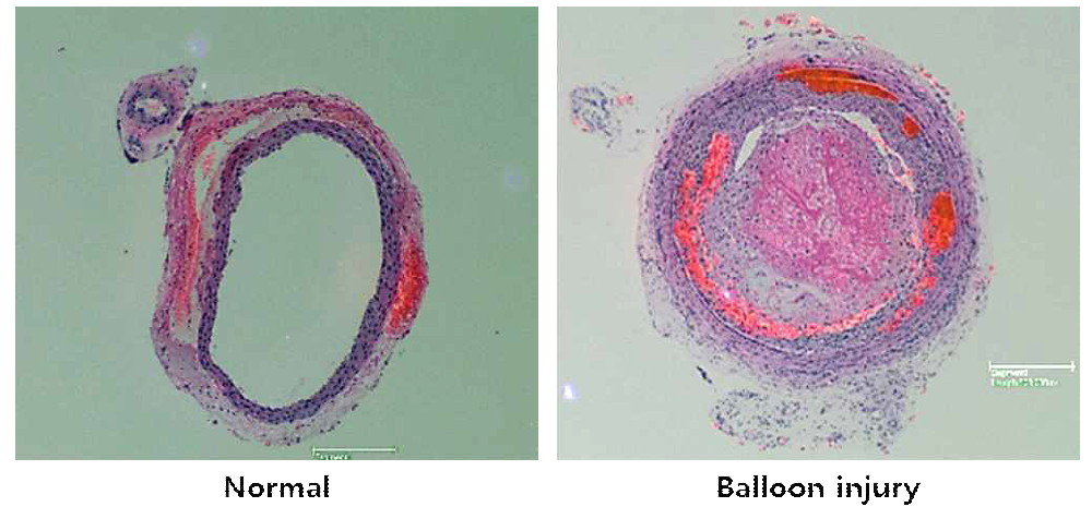 정상혈관과 손상혈관의 비교분석
