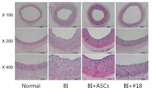 혈관내피 손상모델의 신생내막형성 억제 정도 확인