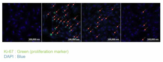 Ki-67 발현 확인