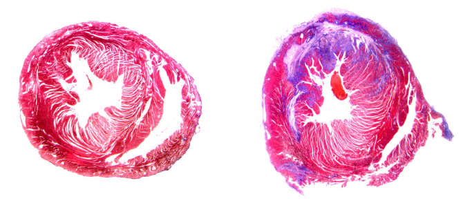 정상심장과 심근경색 유도 모델의 심장