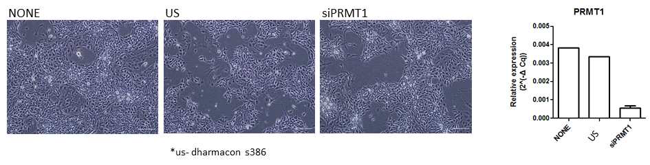 배아 줄기세포 단계에서 siRNA 처리 후 세포의 양상과 PRMT1 mRNA 발현