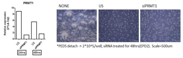 췌장 내배엽 단계에서 siRNA를 처리 후 세포의 양상과 PRMT1 mRNA 발현