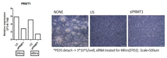 췌장 내배엽 단계에서 siRNA를 처리 후 세포의 양상과 PRMT1 siRNA PRMT1 mRNA 발현