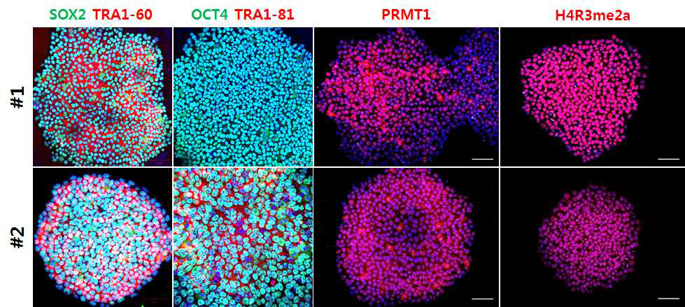 PRMT1 iKO cell line의 pluripotency 마커 발현 및 PRMT1, H4R3me2a의 발현