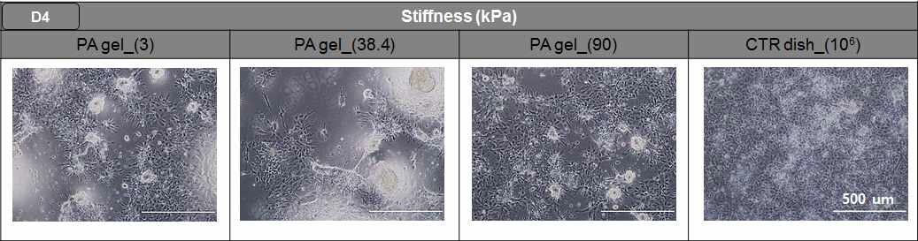 진정 내배엽으로의 분화 후 바닥의 연성도에 따른 세포의 모양 변화