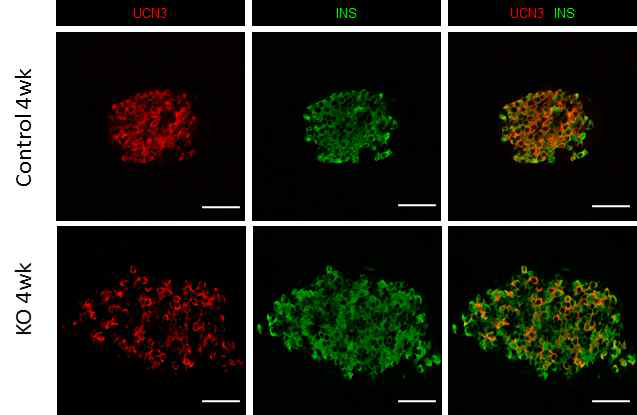 UCN3–INS+ immature β cell이 EKO islet에 관찰됨