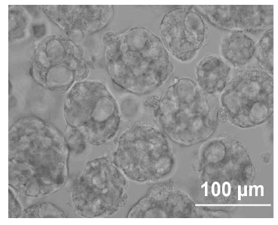 WA01 (H1) hESCs 유래 베타세포 클러스터