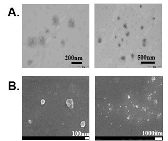 Chol/NC/PEIPEG 나노복합체의 (A) TEM 및 (B) SEM 이미지