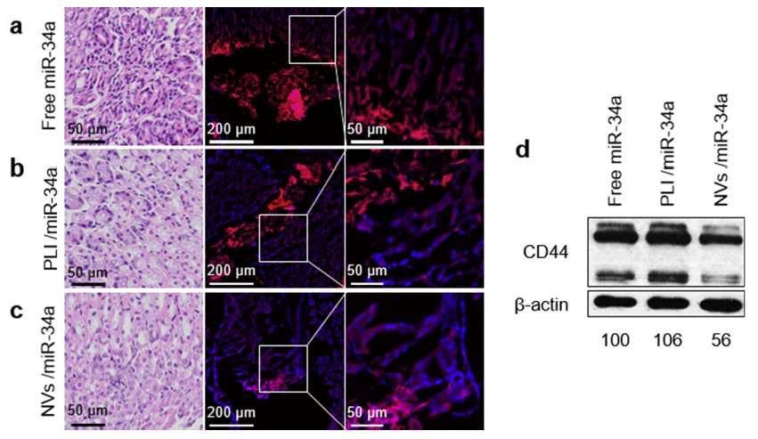 나노전달체를 이용한 miR-34a의 전달에서만 CD44의 억제 확인