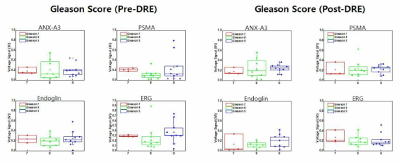 전립선 환자 샘플의 Gleason Socre 대한 바이오마커 신호 분석