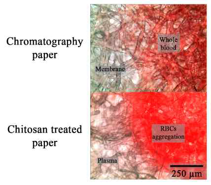 크로마토그래피 종이에 적용된 키토산 용액의 혈액 전처리 효과