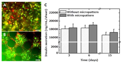 패턴 유무에 따른 바이오페이퍼 내 다종세포형 베타세포 클러스터의 형성 및 인슐린 분비 기능의 차이 관찰. (A) 패턴이 없는 콜라겐 바이오페이퍼 내에서 MIN6 세포와 MS-1 세포를 공배양한 모습. (B) 클러스터 패턴과 이를 이어주는 연결 패턴을 가진 콜라겐 바이오페이퍼 내에서 MIN6 세포와 MS-1 세포를 공배양한 모습. Scale bar = 50 μm