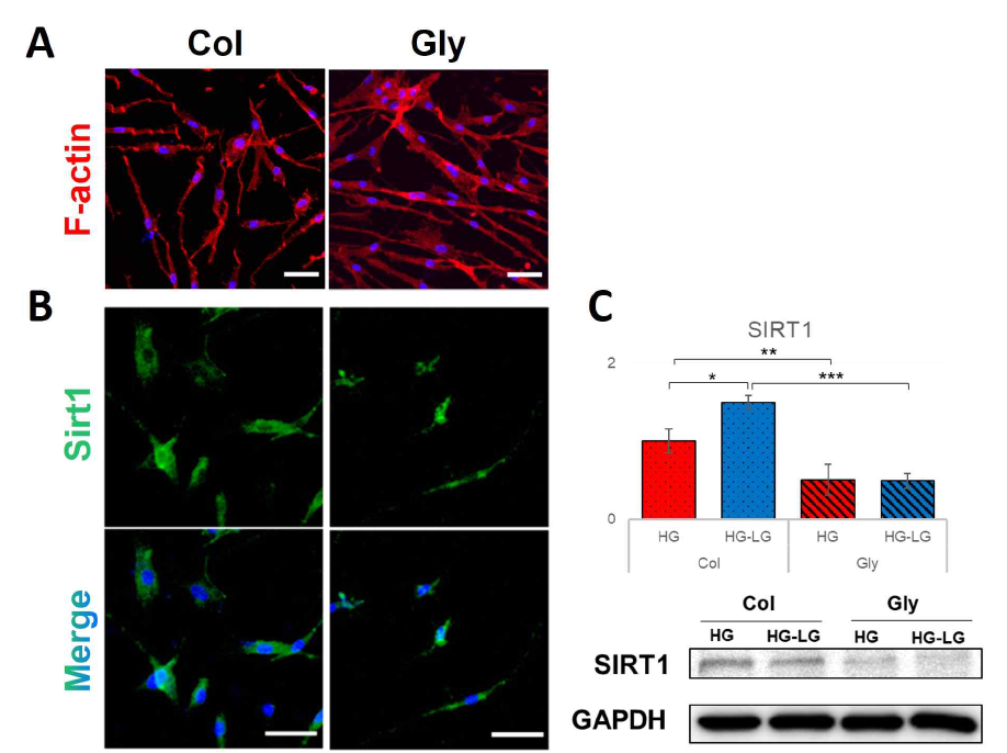 콜라겐Ⅰ 하이드로겔 내 최종당화산물-섬유아세포 상호작용 확인. A. 콜라겐Ⅰ 하이드로겔 내 섬유아세포 형태 변화. B. 조직 내 최종당화산물-섬유아세포 상호작용에 따른 관련 단백질 Sirtuin-1 발현 관찰. C. 최종당화산물과의 상호작용에 따른 섬유아세포 내 Sirtuin-1 유전자 및 단백질 발현 정량 비교