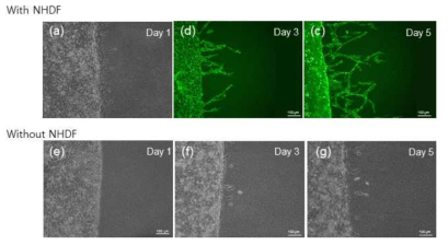 섬유아세포의 유무에 따른 미세혈관형성 영향. 섬유아세포가 존재할 시 패터닝된 혈관으로부터 신생혈관 형성이 유도됨을 확인함